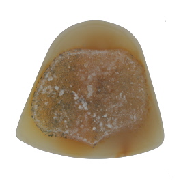 49x46mm Polished Druzy